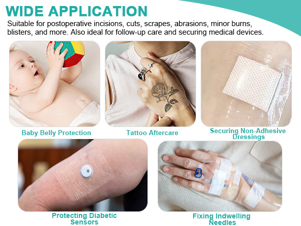 Transparent Film Dressing