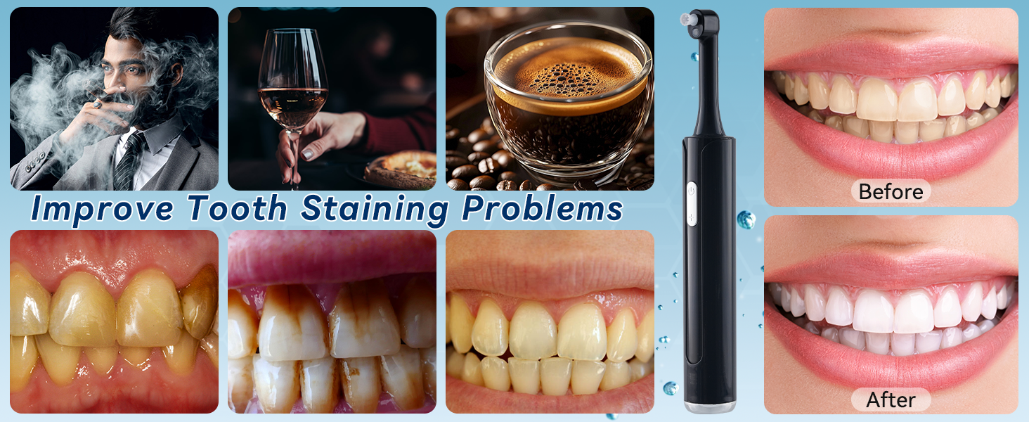 Tooth Polish Tools