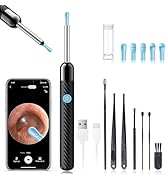 Ear Wax Removal - Earwax Remover Tool with 8 Pcs Ear Set - Ear Canal Cleaner with 1080P Camera - ...