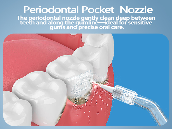 Orthodontic Nozzle