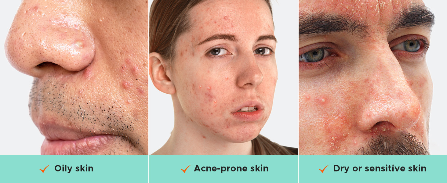 For All Skin Types