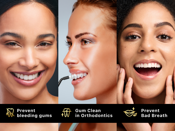 water dental flosser