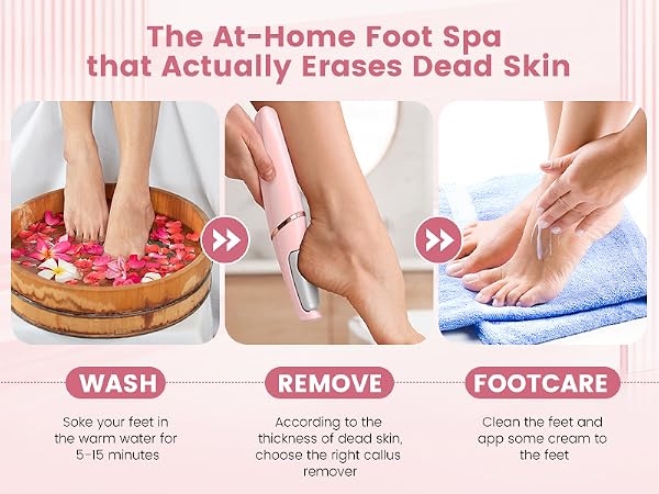 callus remover for feet nuve callus remover electric callus remover for feet