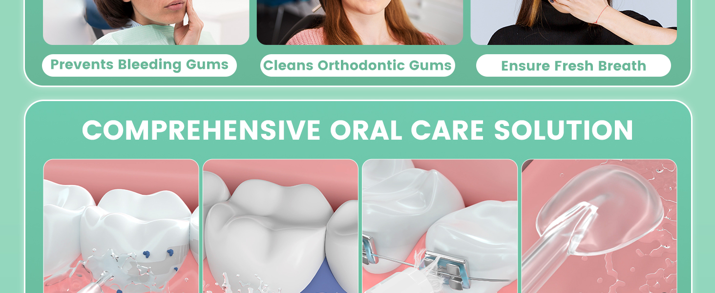 Cordless Water Flosser