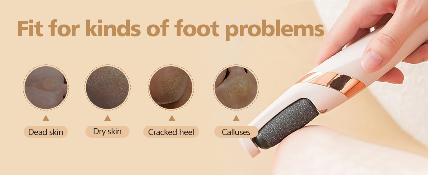 Electric Foot File