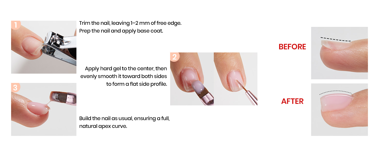 Correct Upward Curving Nails