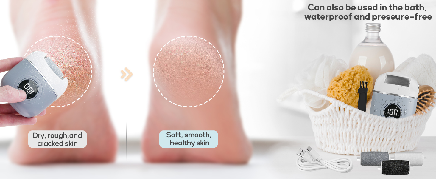 Automatic Electric Callus Remover