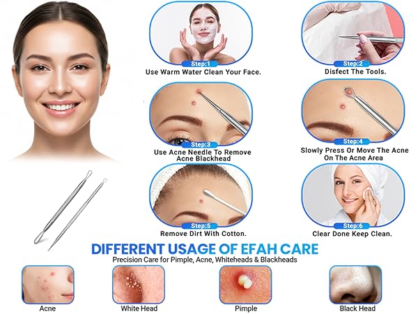 stainless steel pimple extractor