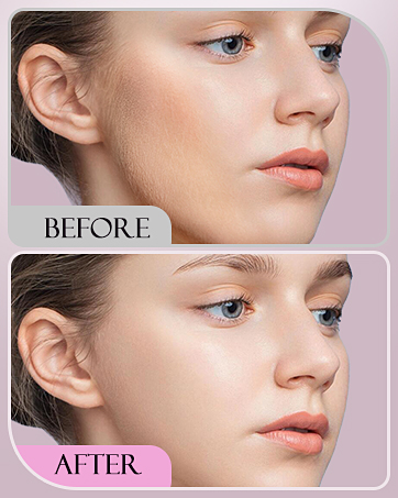 CEVEK Sonic Dermaplaning Tool