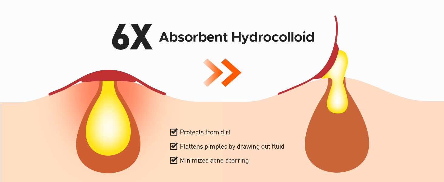 6 X Absorbent Hydrocolloid