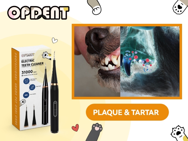 Plaque Remover for Teeth