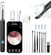NURSETEK Ear Wax Removal, Ear Wax Removal Tool with 1080P HD Camera and 6 LED Lights, Ear Wax Rem...