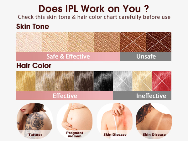 IPL Hair Removal