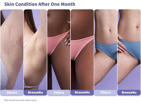 Skin Condition After One Month