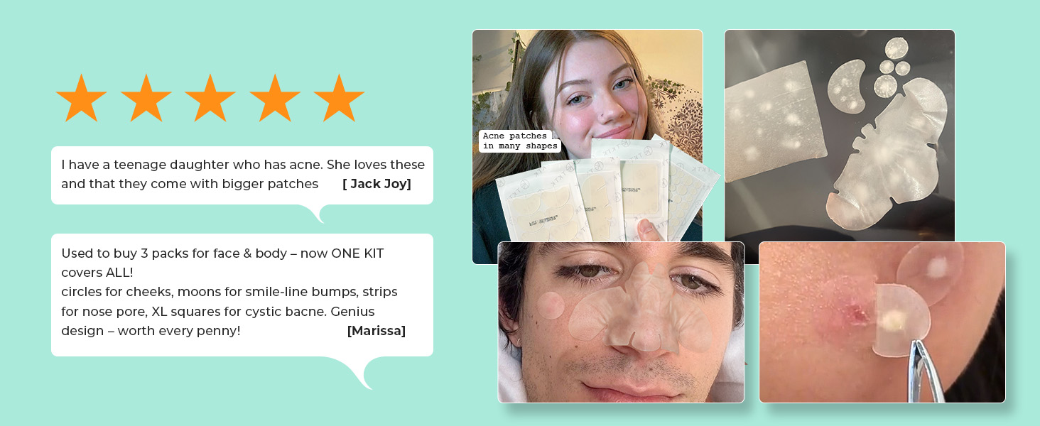 Reviews