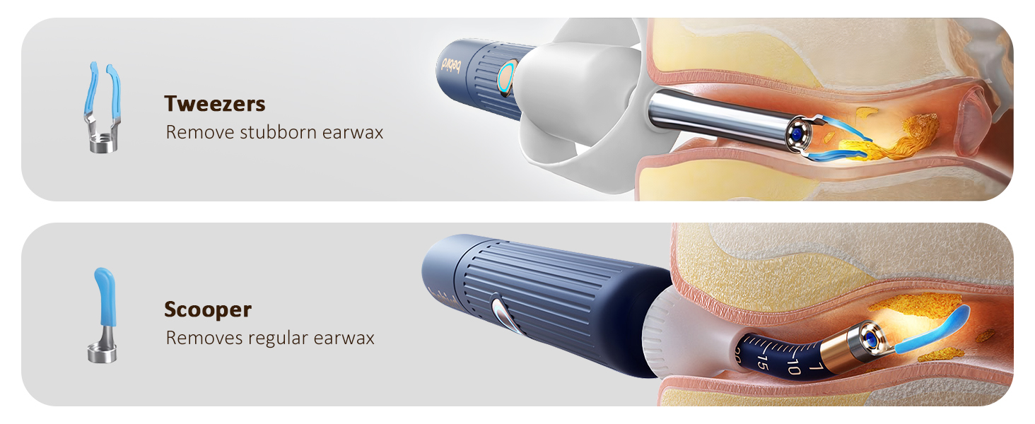 ear camera wax removal