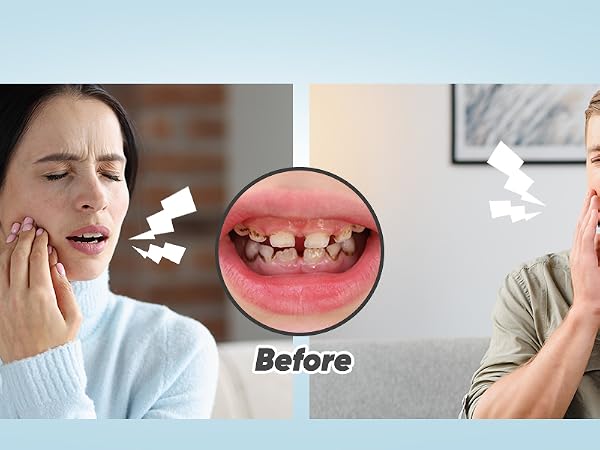 dental polisher