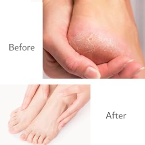 Cleaning and protection