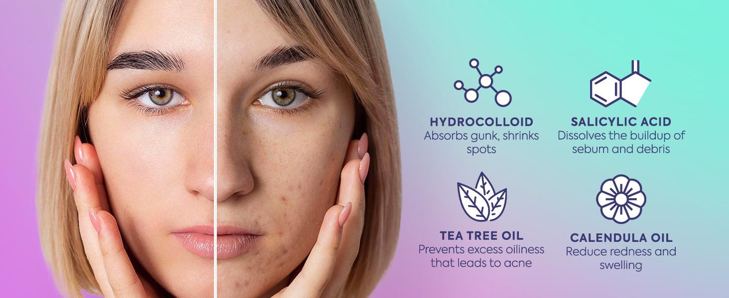 330 CT Circle Pimple Patches w/ Ingredients