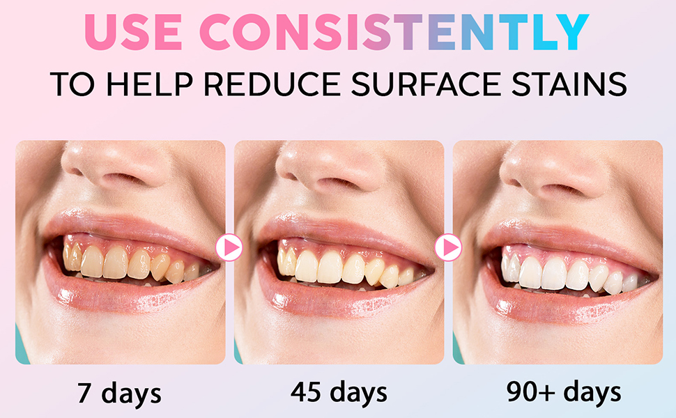 Niacinamide Whitening Toothpaste