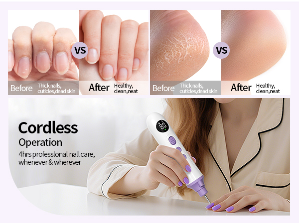 Electric Nail File