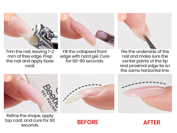 Correct Downward Curving Nails