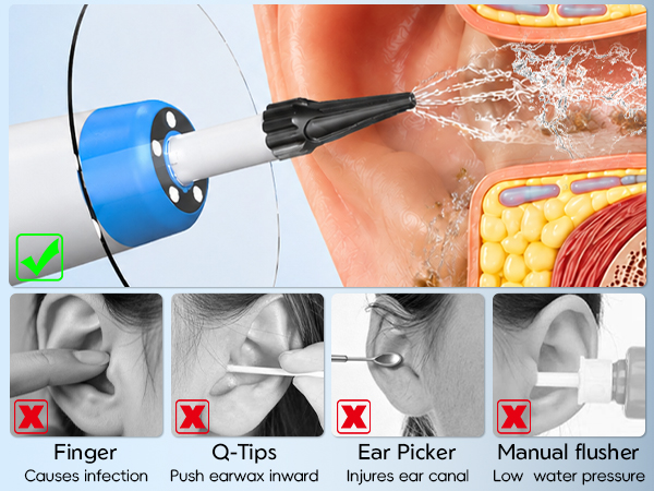 ear wax removal