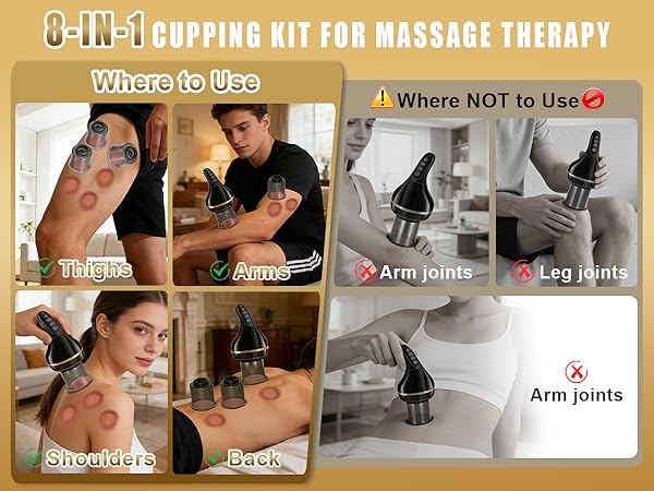 Cupping Kit for Massage Therapy