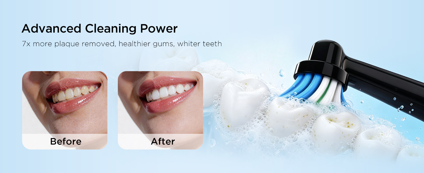 electric toothbrush