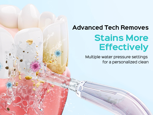 COSLUS Excellent Water Flosser
