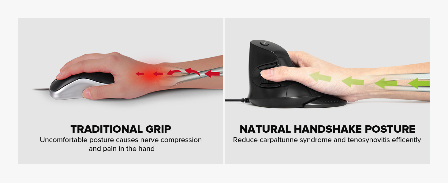compare to traditional mouse