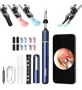 Bebird Pro Note5 Ear Wax Removal Tool Camera Tweezers, Ear Cleaner Scope Otoscope with Camera &amp; L...
