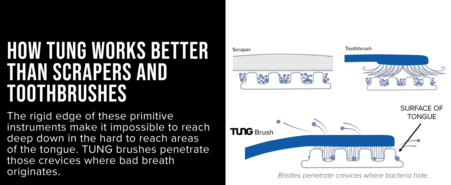 TUNG Brush &amp;amp; Gel - The most effective way to forget about bad breath anxiety – permanently.