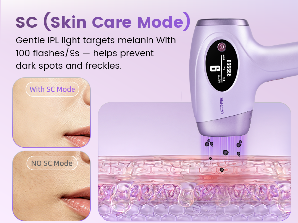 ipl hair removal