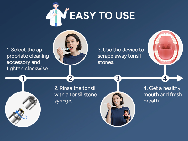 Tonsil Stone Remover with Camera