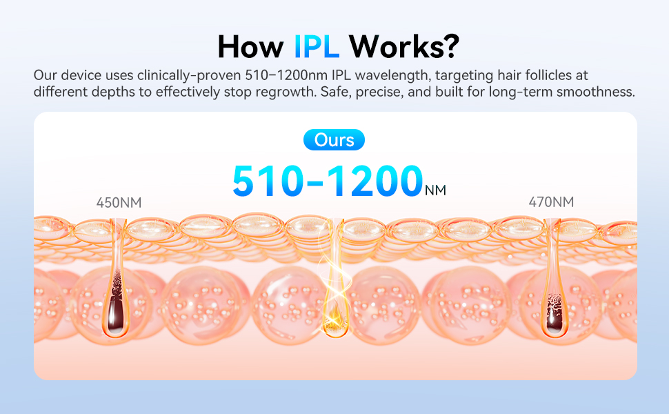 How IPL Works