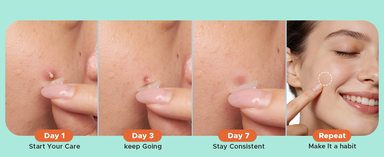 pimple patches
