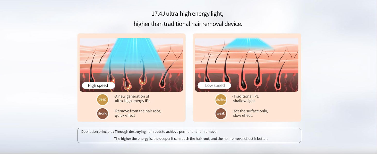 Laser Hair Removal,999,900+ Flashes IPL Hair Removal Device for Women and Men