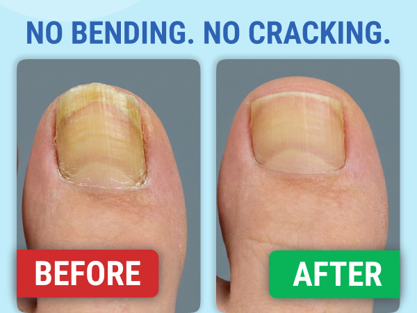 toe nail clippers