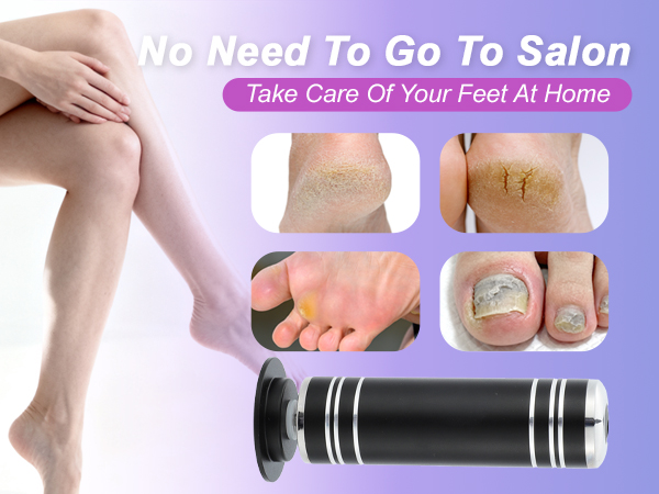 Electric Foot Callus Remover