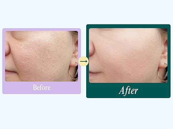 before and after 3
