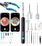 BEBIRD R1 Ultra Ear Wax Removal, Ear Cleaner with Camera Ear Scope, Wax Remove Ear Pick with Ear ...