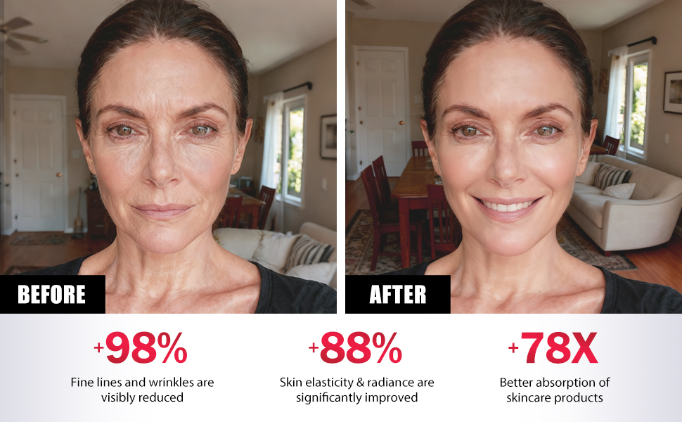 Microcurrent Facial Device
