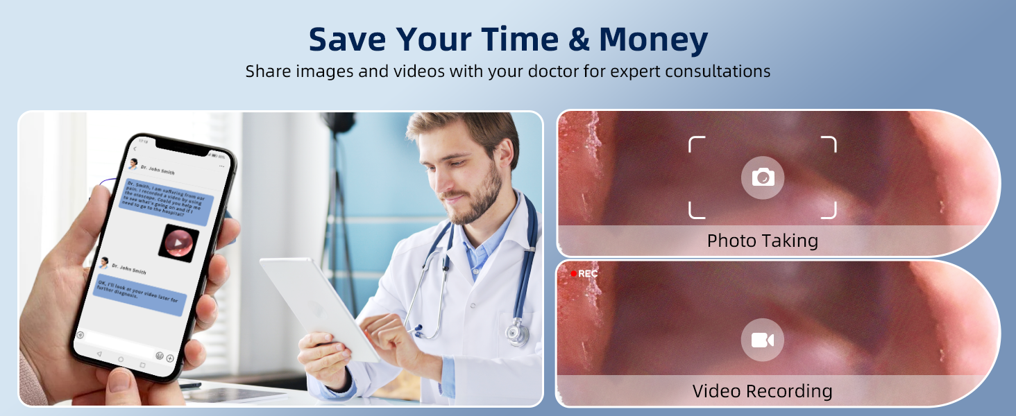 otoscope ear camera