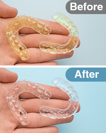 Aligner
