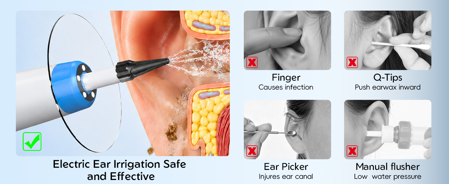 ear wax removal