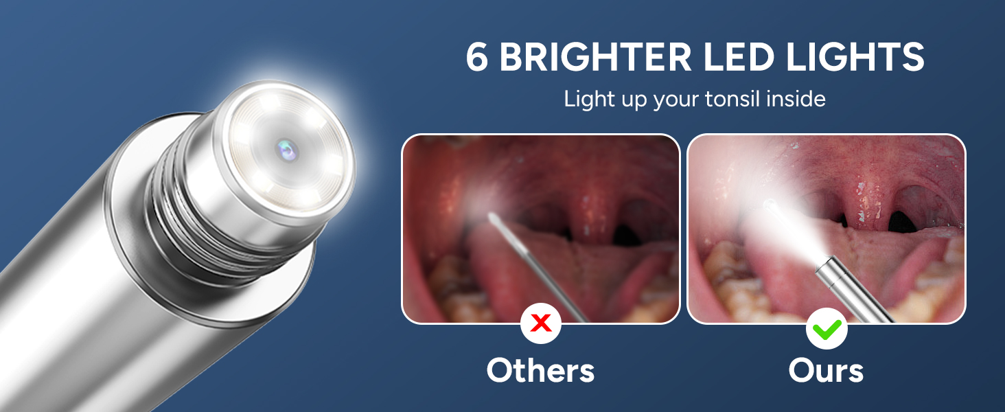 Tonsil Stone Remover with Camera