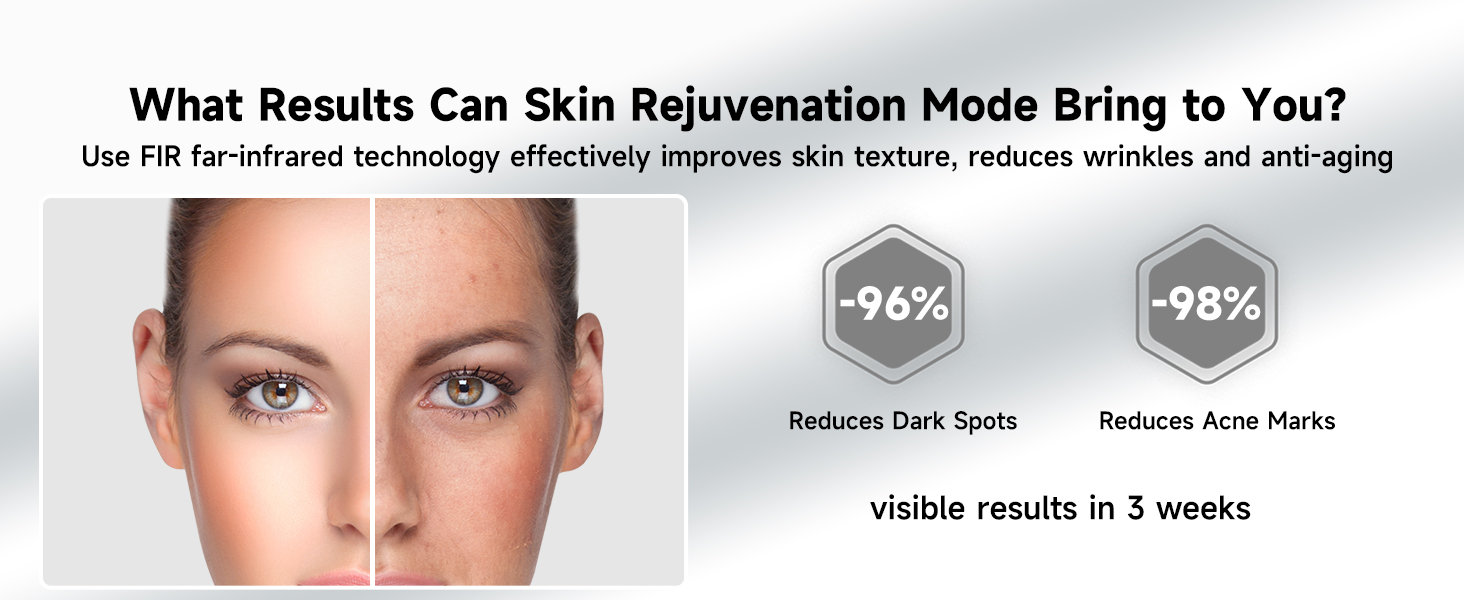 laser hair removal for women