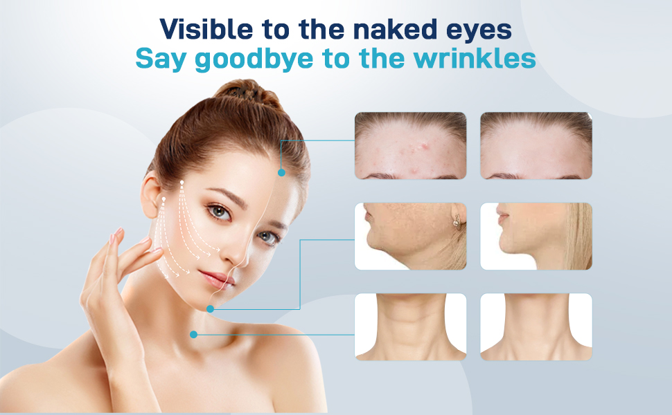 Skincare product advertisement showing before and after comparisons of facial areas, highlighting potential wrinkle reduction effects on forehead, cheeks, and neck.