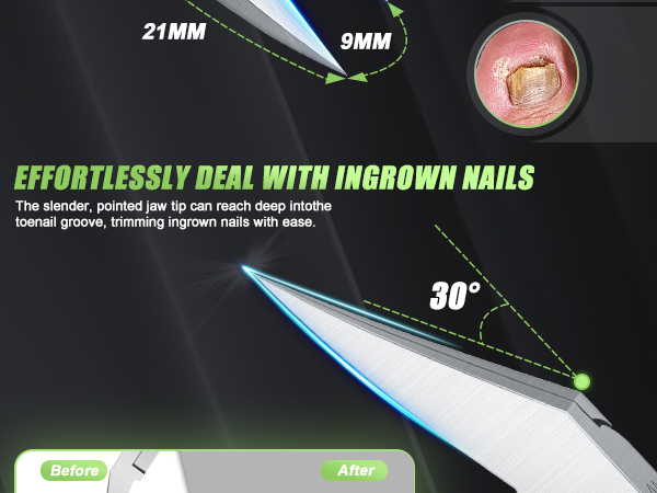 toenail clippers